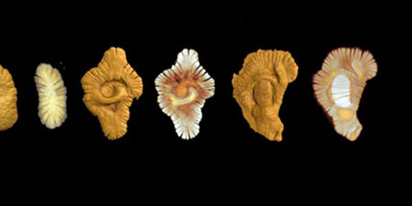 Article teaser image