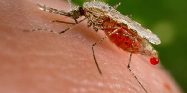 Article teaser image