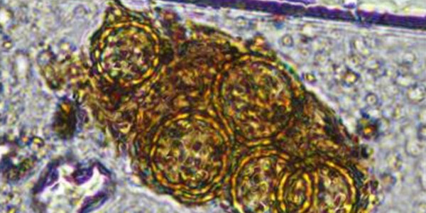 Article teaser image