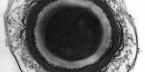 Article teaser image