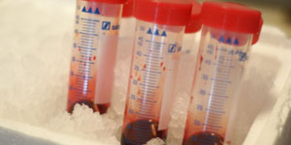 Haem02 Project: Artificial Blood Gets Third Generation Technology