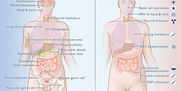 Article teaser image