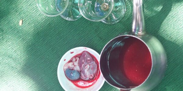 Article teaser image