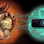 Article teaser image