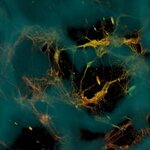Article teaser image