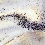 Article teaser image