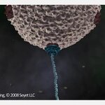 Article teaser image