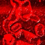 Article teaser image