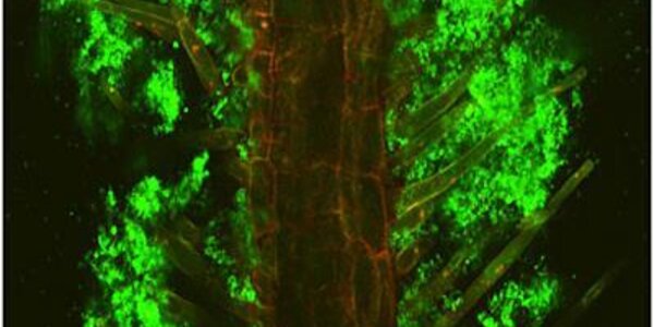 Article teaser image