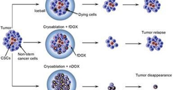 Article teaser image