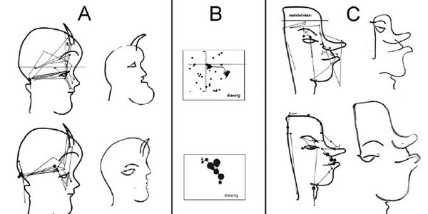 Article teaser image