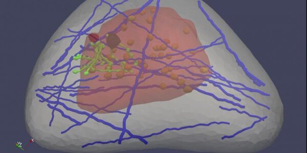 Article teaser image