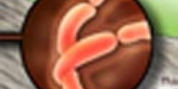 Article teaser image