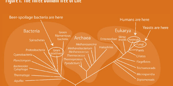 Article teaser image