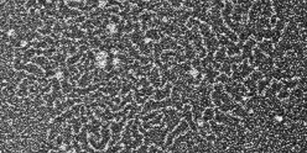 Article teaser image