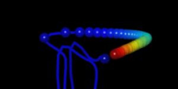 Article teaser image