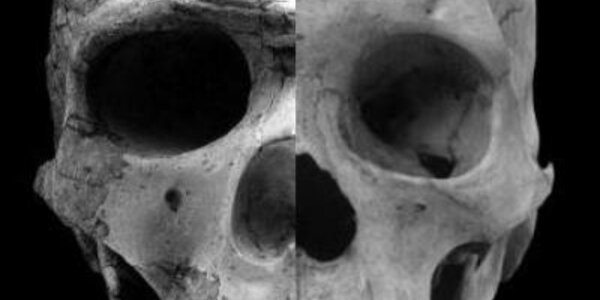 Article teaser image