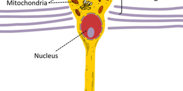 Article teaser image