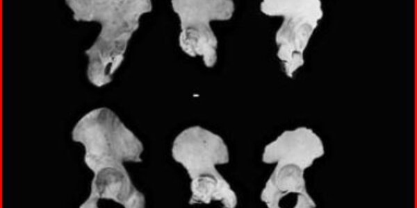 Article teaser image