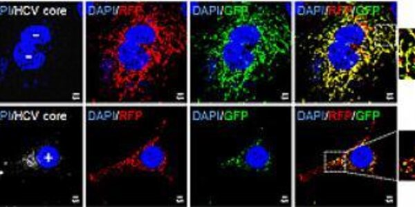 Article teaser image