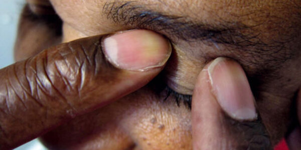 Article teaser image