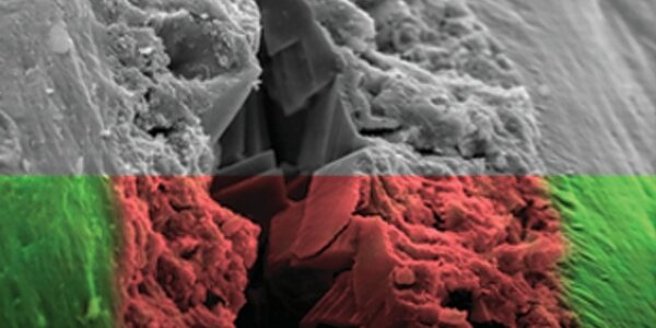 Article teaser image