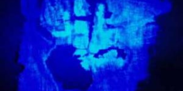 Article teaser image