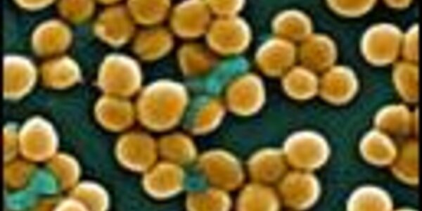 Article teaser image