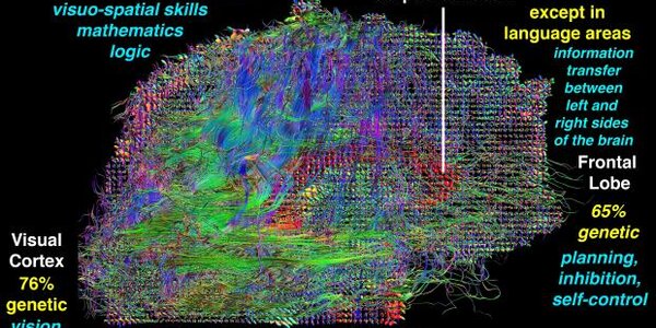 Article teaser image