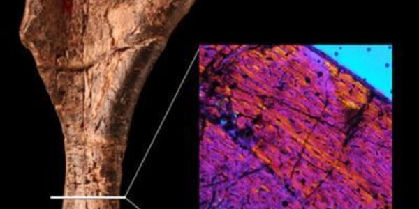 Article teaser image