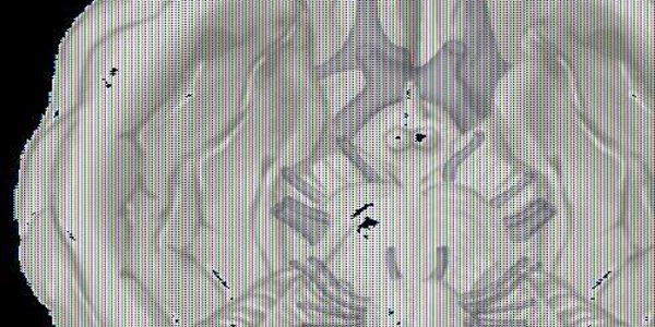 Article teaser image