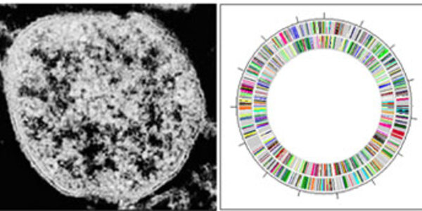 Article teaser image