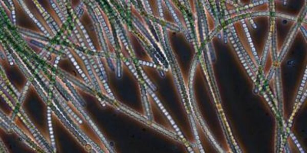 Article teaser image