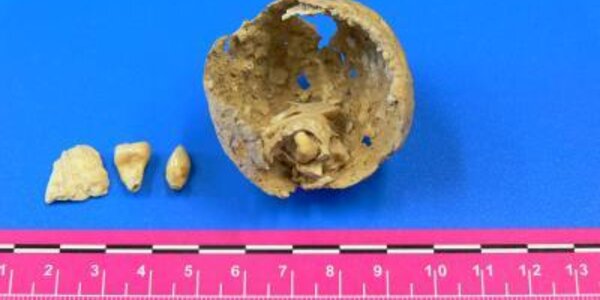 Article teaser image