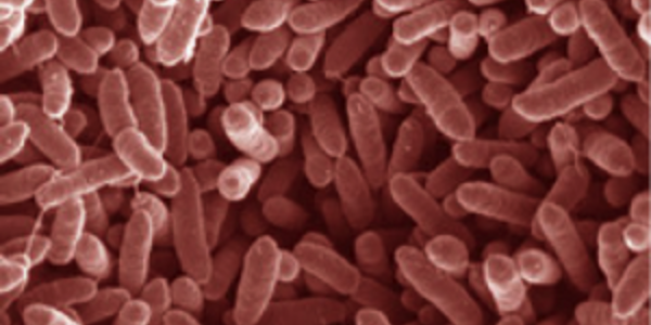 Article teaser image