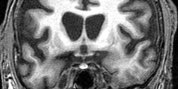 Article teaser image