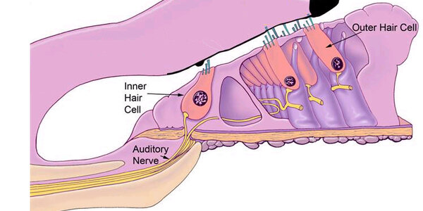 Article teaser image