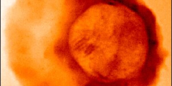 Article teaser image