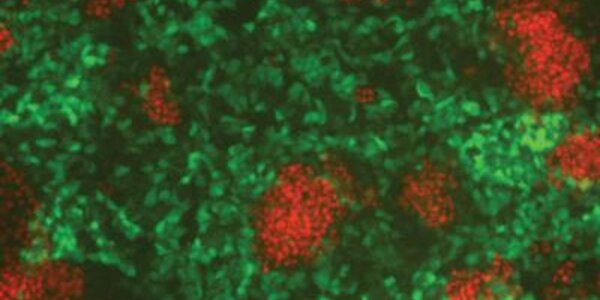 Article teaser image