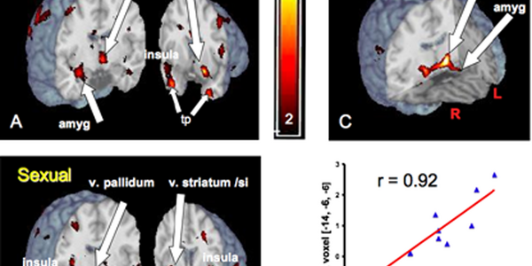 Article teaser image