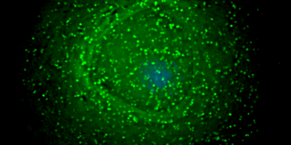 Article teaser image