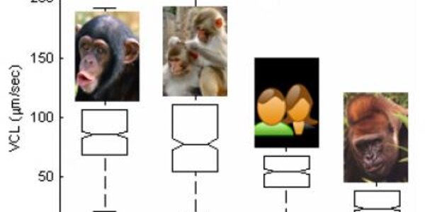 Article teaser image