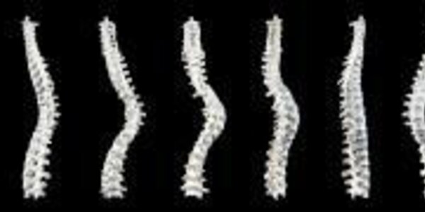 Article teaser image