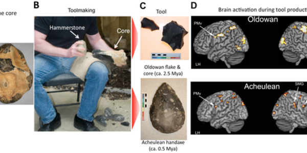 Article teaser image