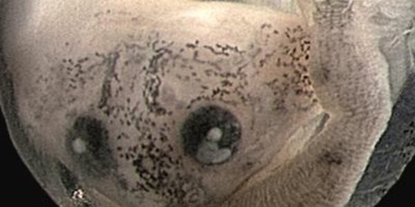 Article teaser image