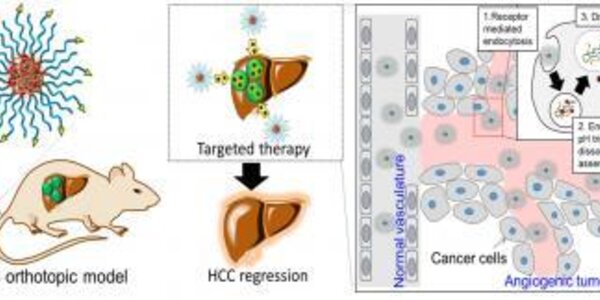 Article teaser image