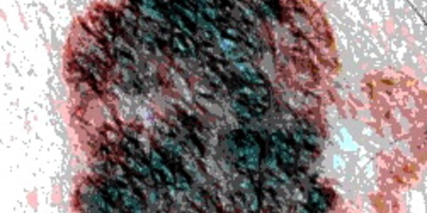 Article teaser image