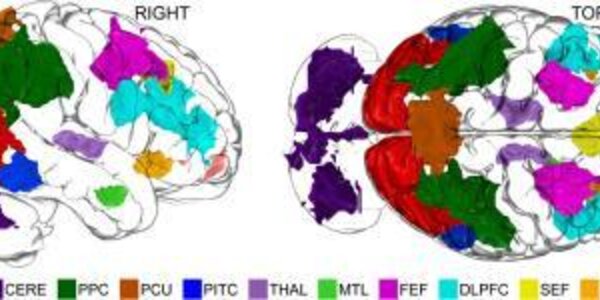 Article teaser image