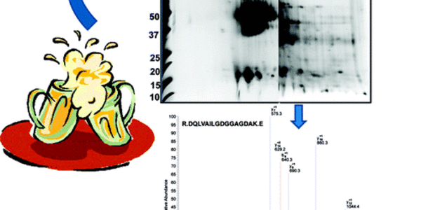 Article teaser image