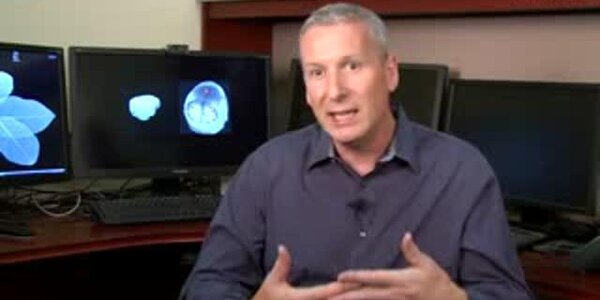 Article teaser image